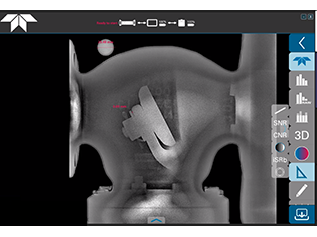 Digital Radiography System (DRS)